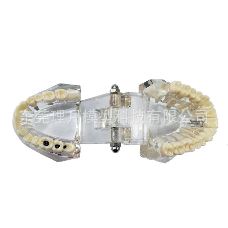 Смоляная съемная модель зубов стоматологическая передвижная патологическая