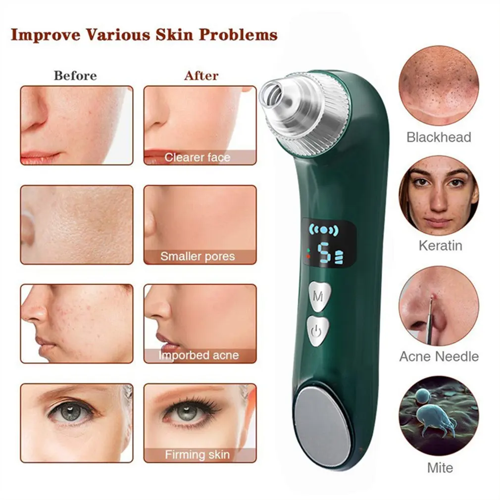 

Portable Visible Blackhead Remover With Camera Pore Cleaner Hot Compress Pimple Removal Skin Beauty Devices