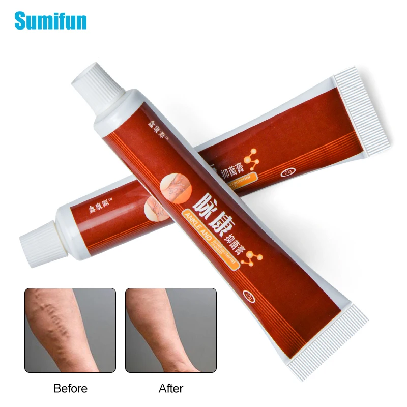 Крем мазь для лечения варикоза васкулита фалбита боли паука удаление ангиита