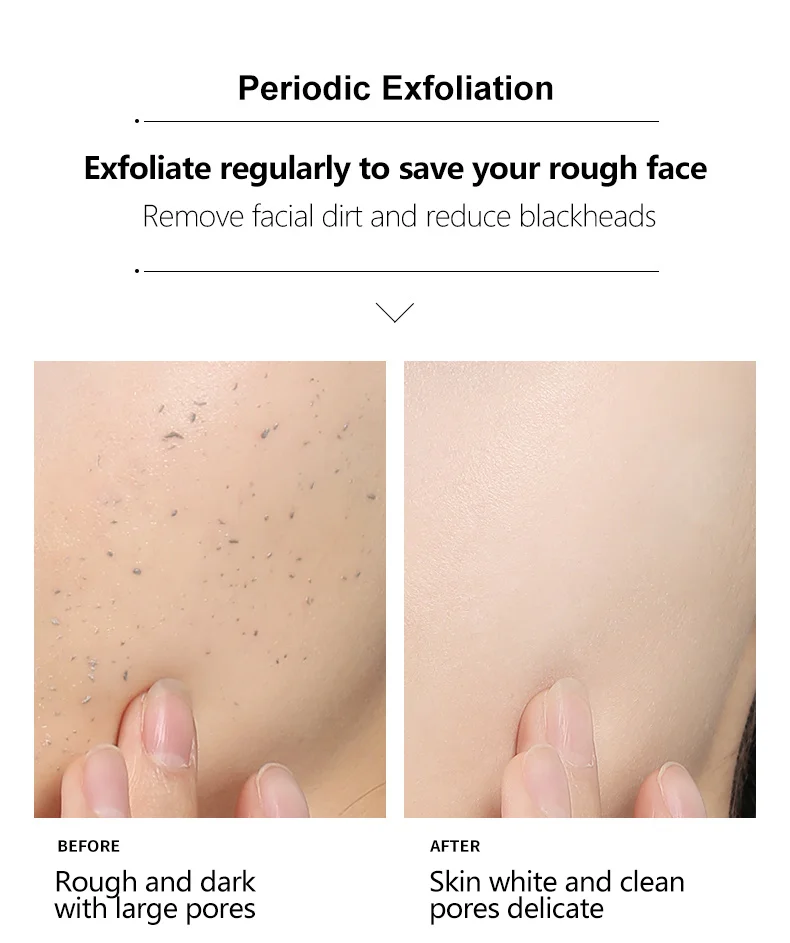 WXE отшелушивающий для лица мусс очищения пилинг Усадочные поры Удаление угрей