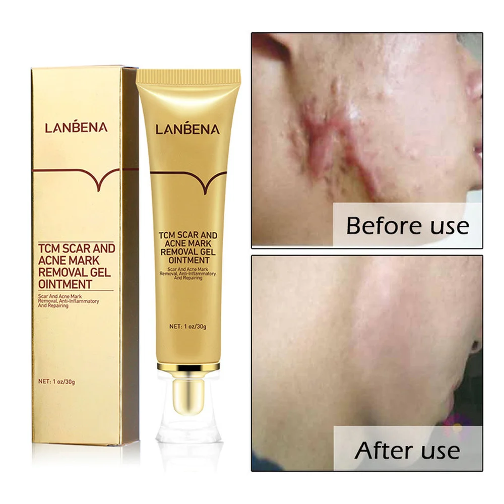 

LANBENA Original Herbal Acne Scar Removal Gel Spots Treatment Stretch Marks Removal Pigmentation Corrector Whiting Cream 30g