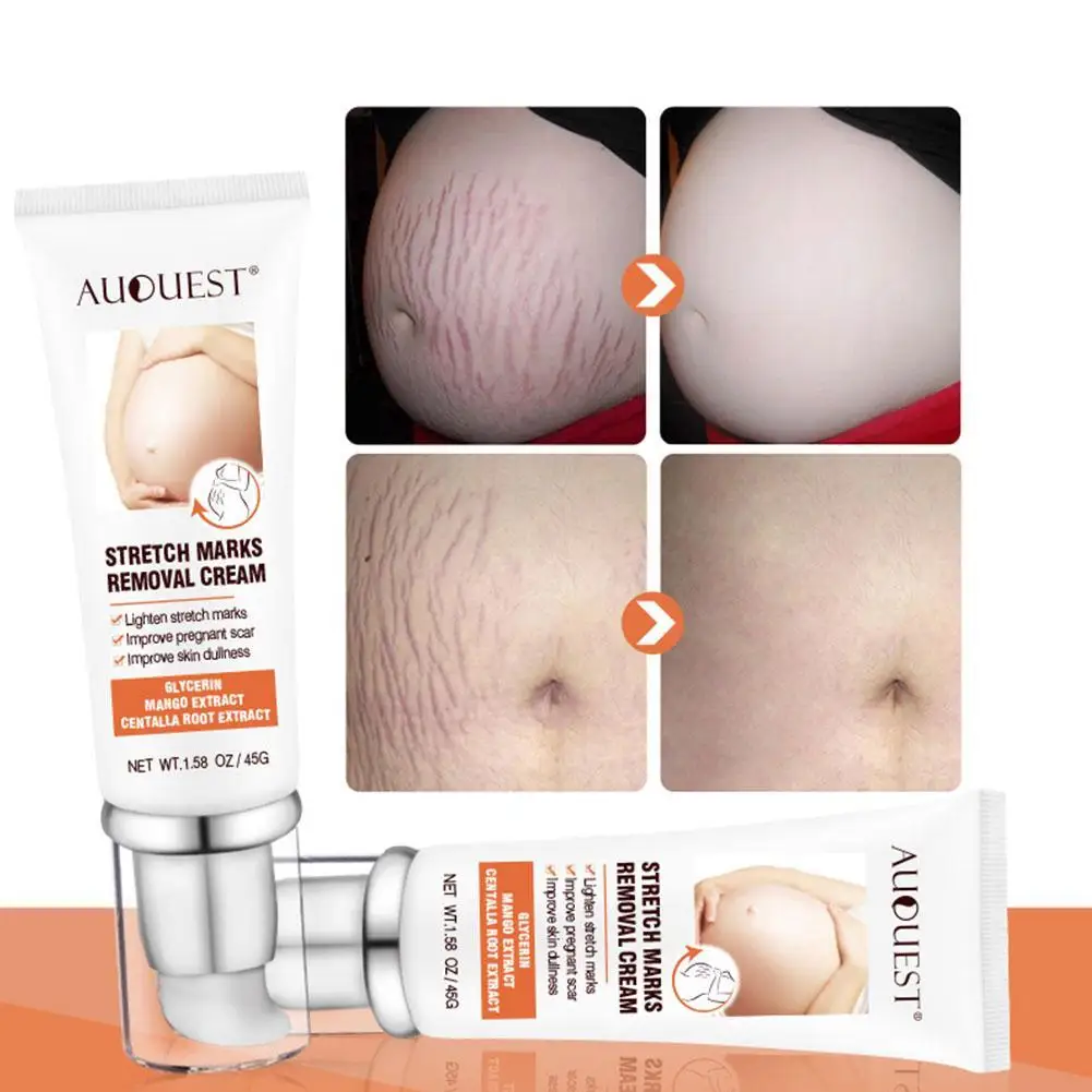 

Scar Stretch Marks Removal Acne Treatment Whitening Acne Scar Removal For Pregnant Cream Skin Cream Moisturizing Care Remov M1D4