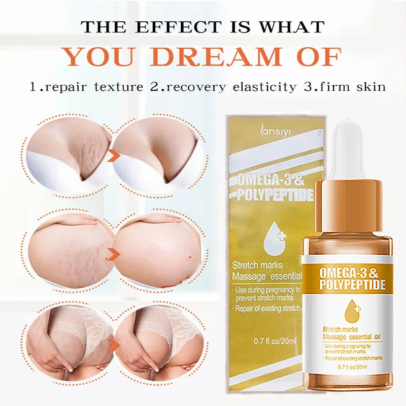 Средство для удаления растяжек эфирное масло крем ухода за кожей Удаления