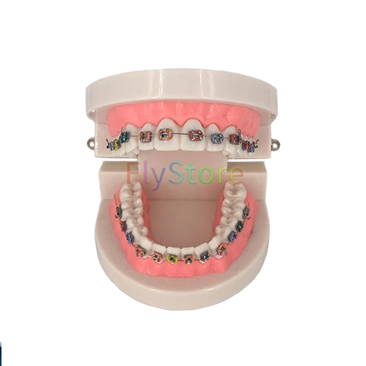 1 шт. Стоматологическая Ортодонтическая модель зуба с Орто-металлическим