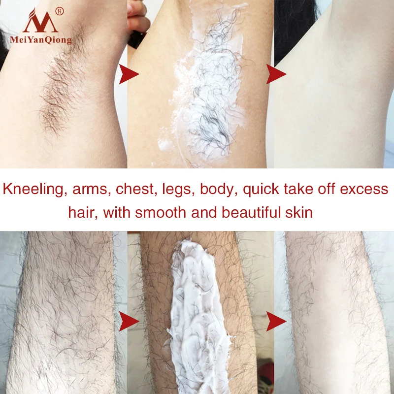 5 шт. Женский Мужской травяной крем для депиляции удаление волос безболезненный