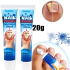 Крем для удаления грибка ногтей, мазь для ухода за ногтями, гель для удаления грибка ног, противоинфекционный крем для восстановления ногтей паронихией, 1 шт.