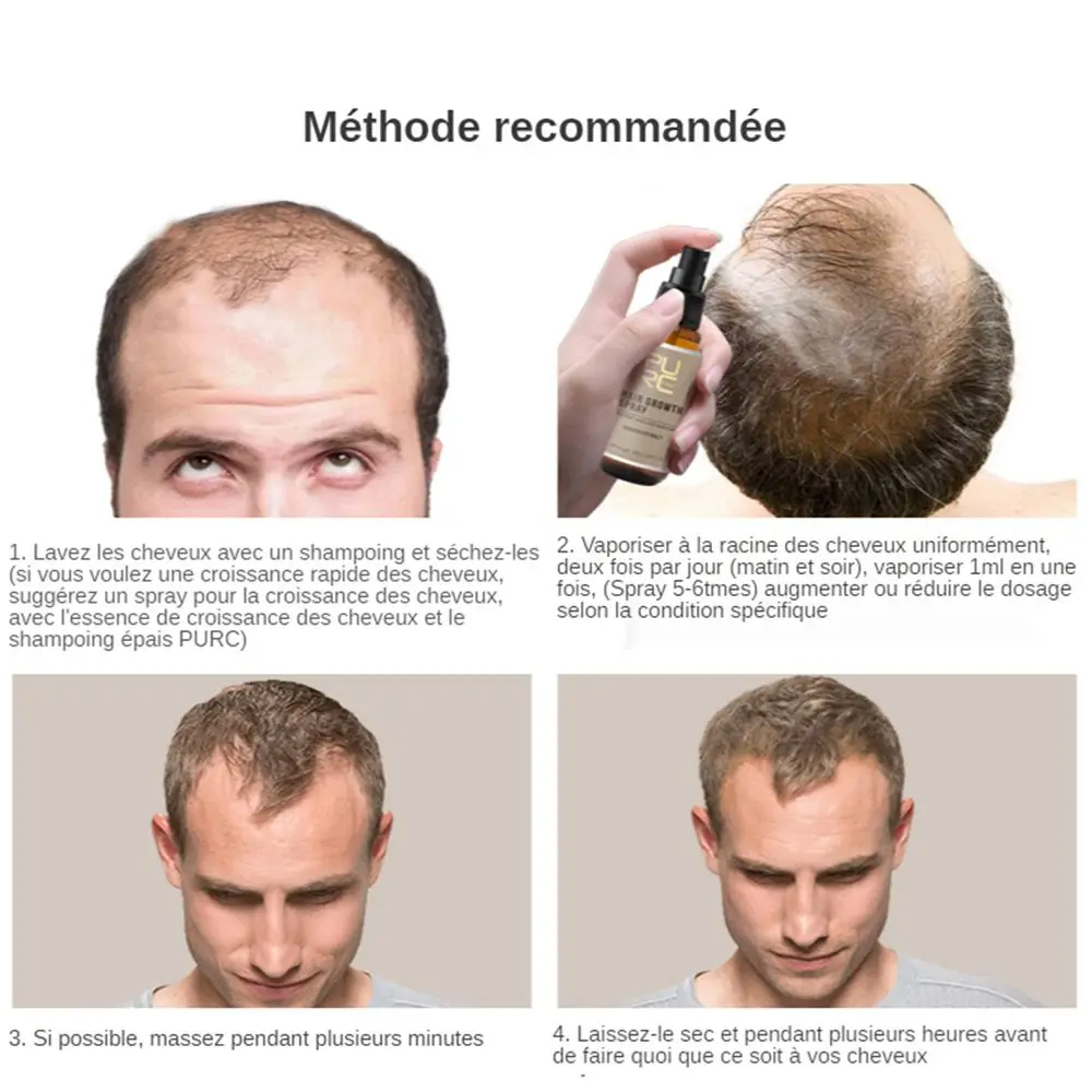 Уход за кожей головы и имбиря 20 мл | Красота здоровье