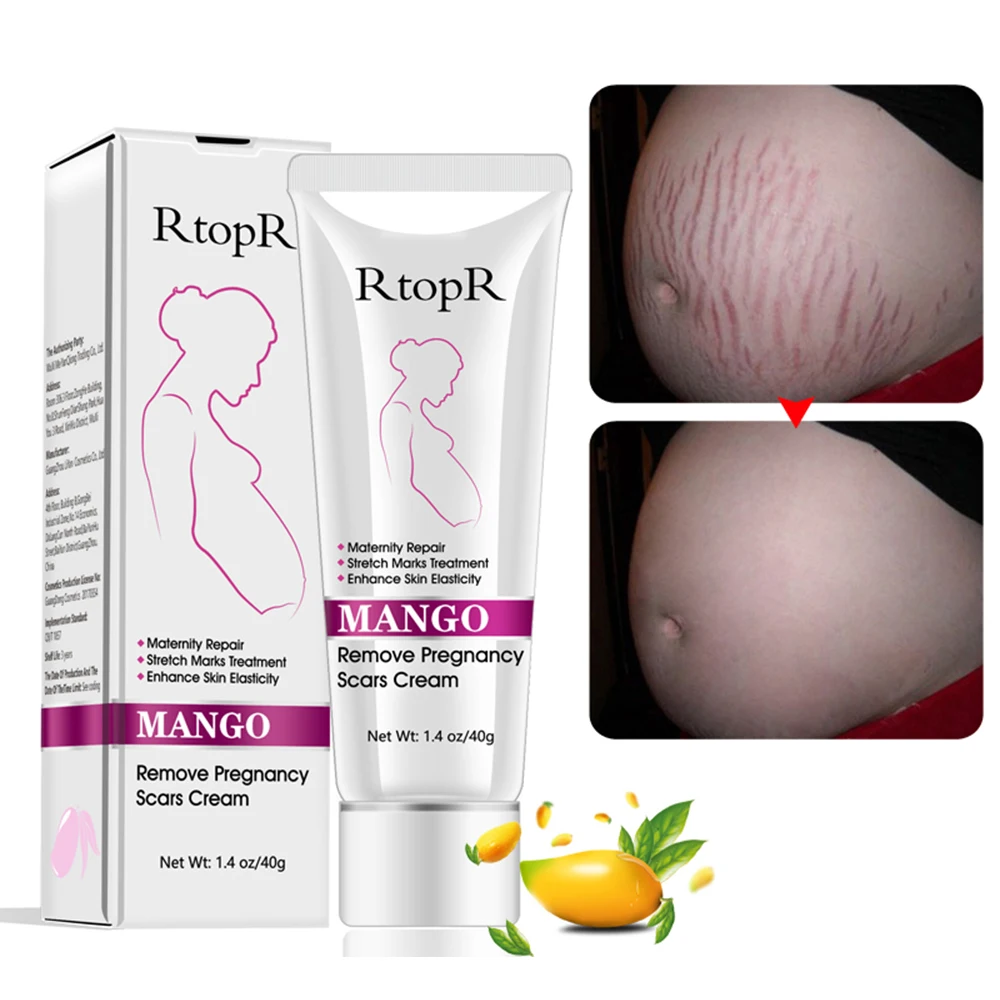 

RtopR 40ml Mango Stretch Marks Remover Cream Eliminate Pregnancy Scars Maternity Repair Anti Winkle Skin Firming Treatment TSLM1