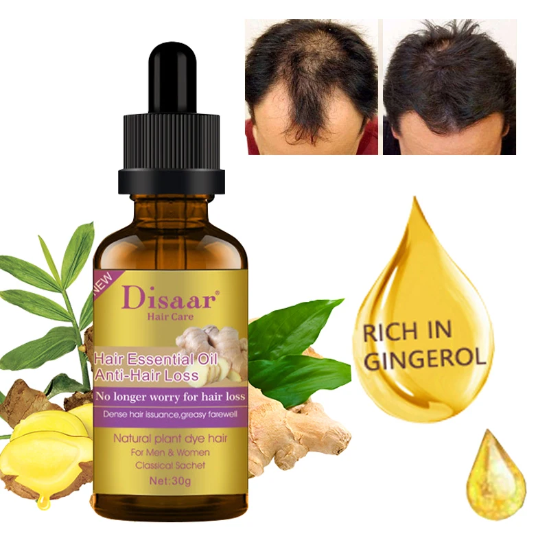 

7 Days Ginger Hair Growth Essence Oils Fast Hair Growth Serum Hair Loss Treatment Germinal Prevent Baldness Anti-hair Loss Care