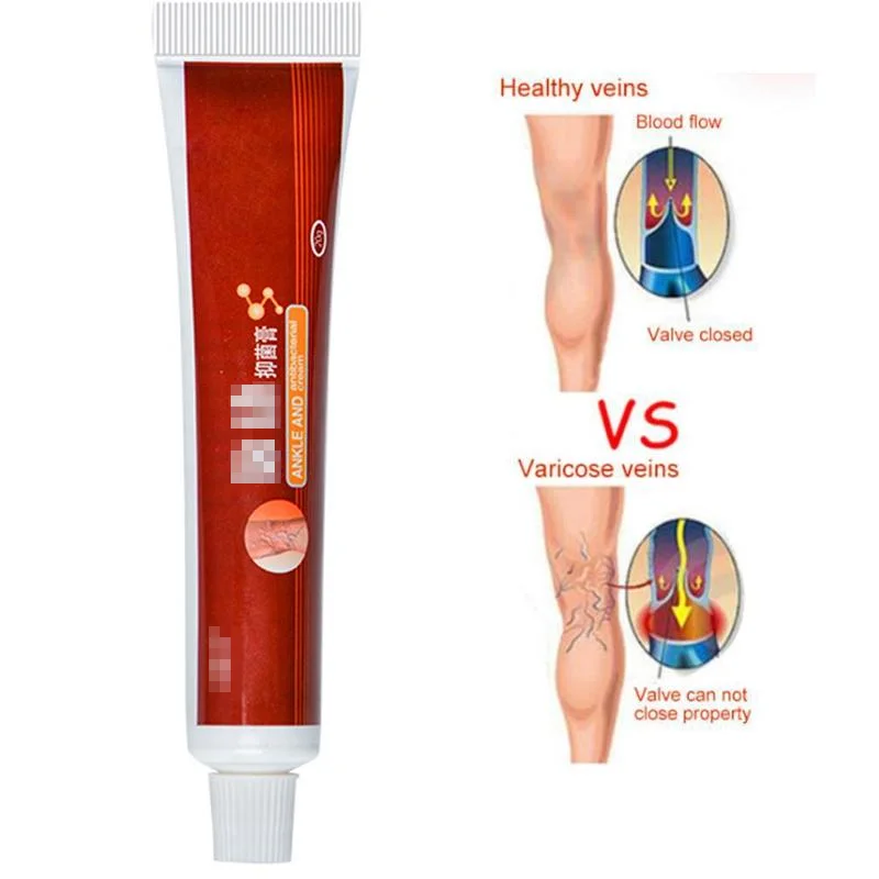 

1pc Varicose Veins Treatment Cream Relief Veins Pain Phlebitis Legs Varicosity Angiitis Remedy Ointment Health Care