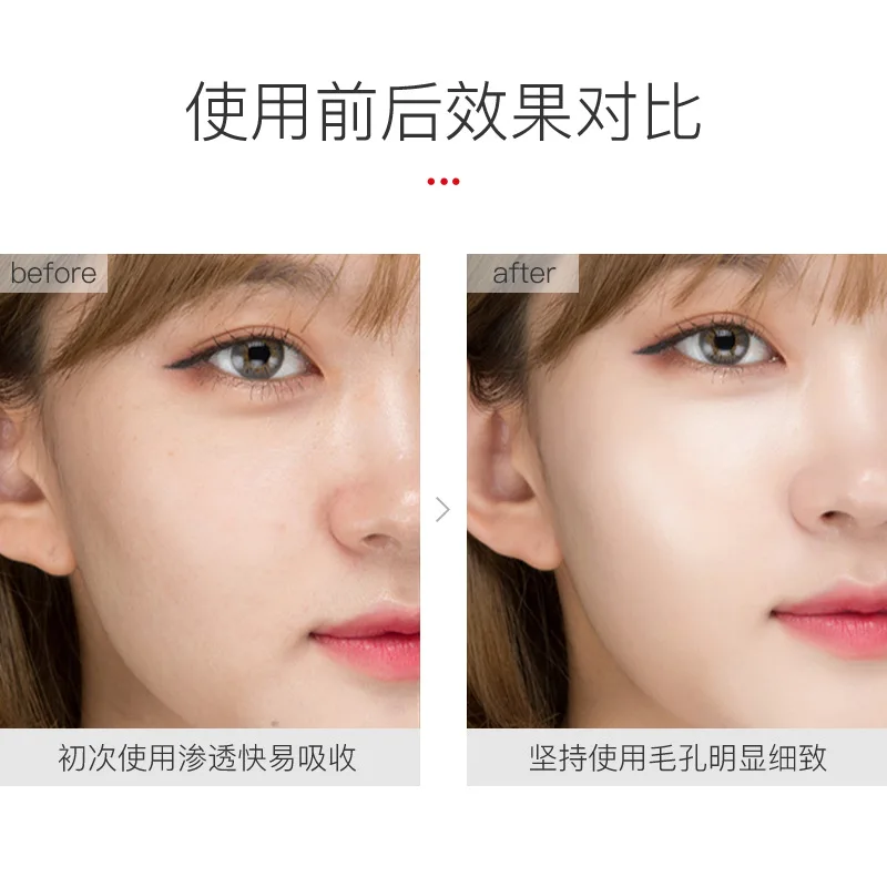 

VENZEN nicotinamide skin moisturizing and replenishing essence improves pore moisturizing nicotinamide solution