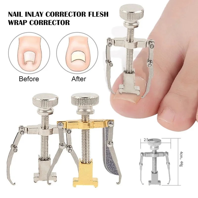 

Ingrown Toenails Correction Tool Foot Toe Nail Care Tools Straightening Clip Brace Corrector Feet Pedicure Treatment Adjuster