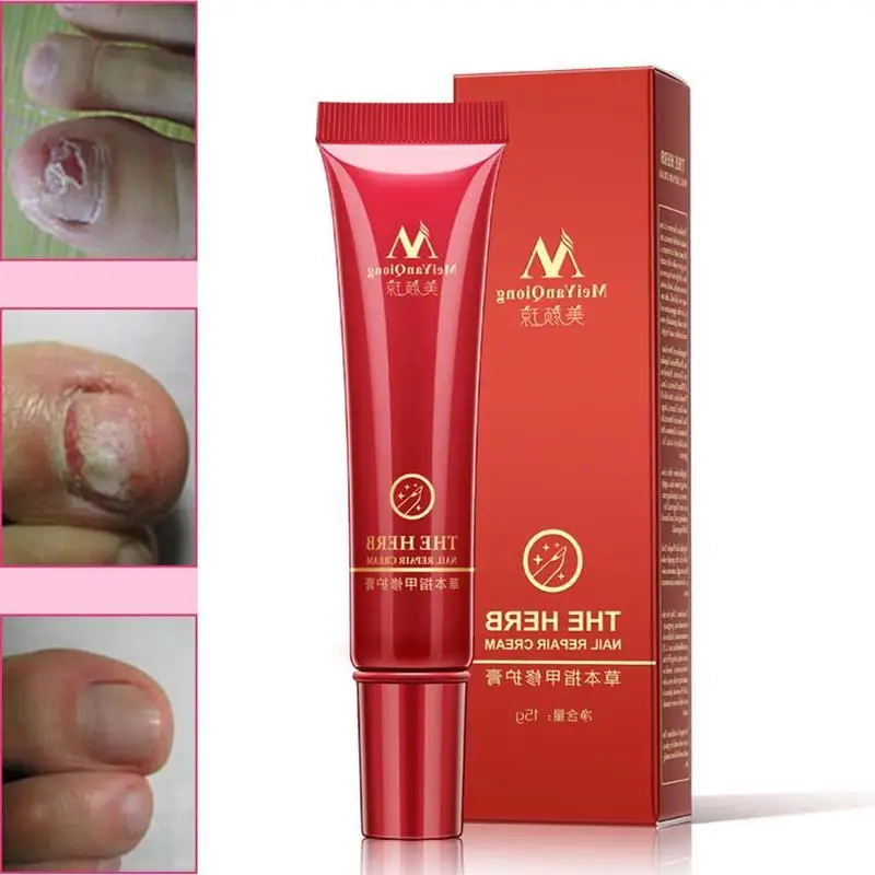 LULAA High Quality Useful Herb Nail Repair Cream Anti Nail Fungus Treatment Fungal Herb Cream Nails Tools Repair Care Nail E6Q4
