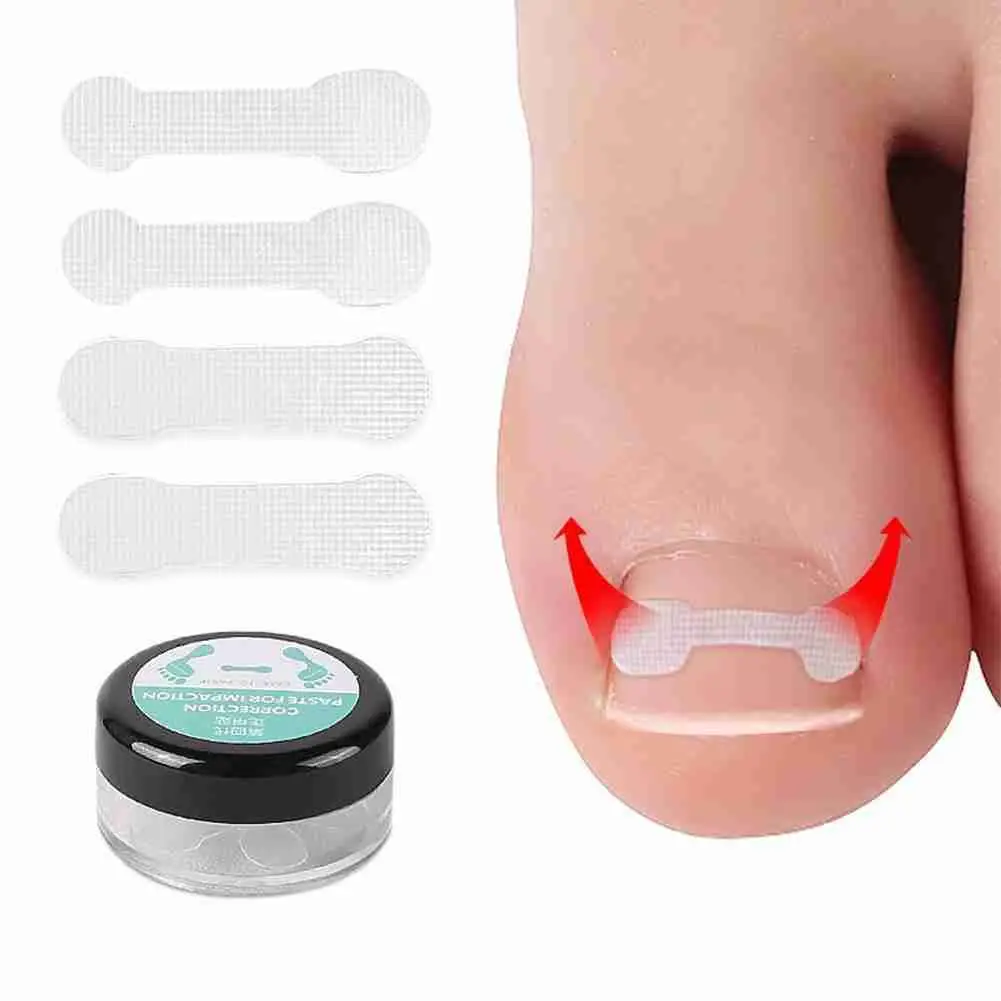 

10 Transparent Nail Correction Tablets Ingrown Toenail Treatment Elastic Patch Correction Pedicure Tool