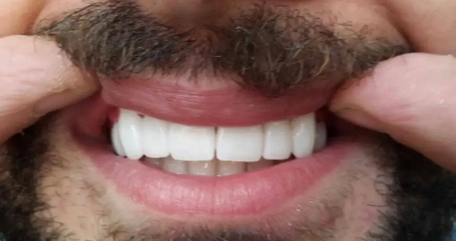 UT Экстремальный отбеливатель цветной многослойный сверхпрозрачный