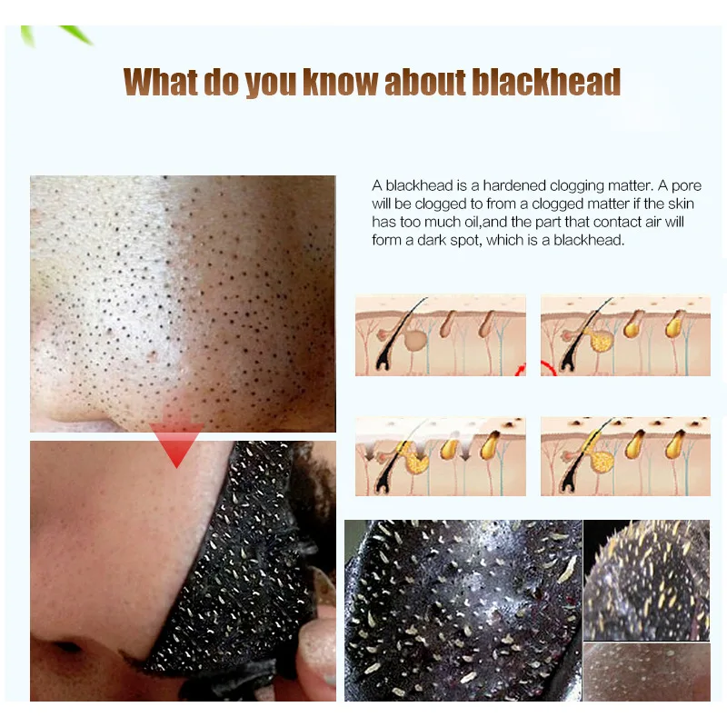 

20pcs Face Mask Oil Control To Remove Blackheads and Pores Shrinking Facial Care Mask Whitening Moisturizing Cream