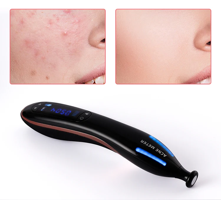Профессиональная плазменная ручка для удаления шрамов и акне лечение морщин