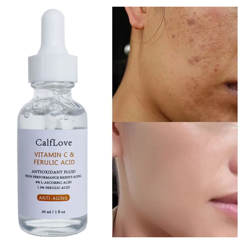 

Vitamin C Whitening Facial Serum Remove Dark Circles Fade Freckles Spot Melanin Brightening Anti-Aging Moisturizing Face Essence