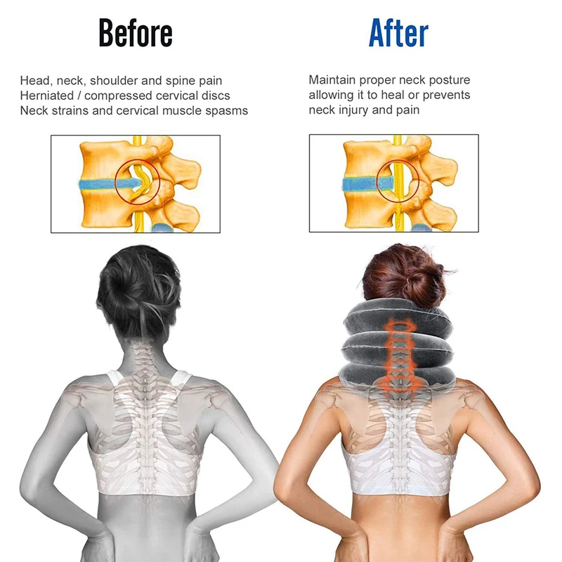 

Inflatable Air Cervical Neck Traction Device Tractor Support Soft Massage Pillow Pain Relief Neck Stretcher Support Relaxation