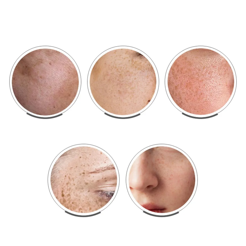 

15ML VC Whitening Freckle Curing Cream brightening skin tone facial moisturizing