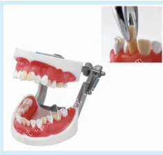 

Teeth study model for tooth preparation /practice extraction