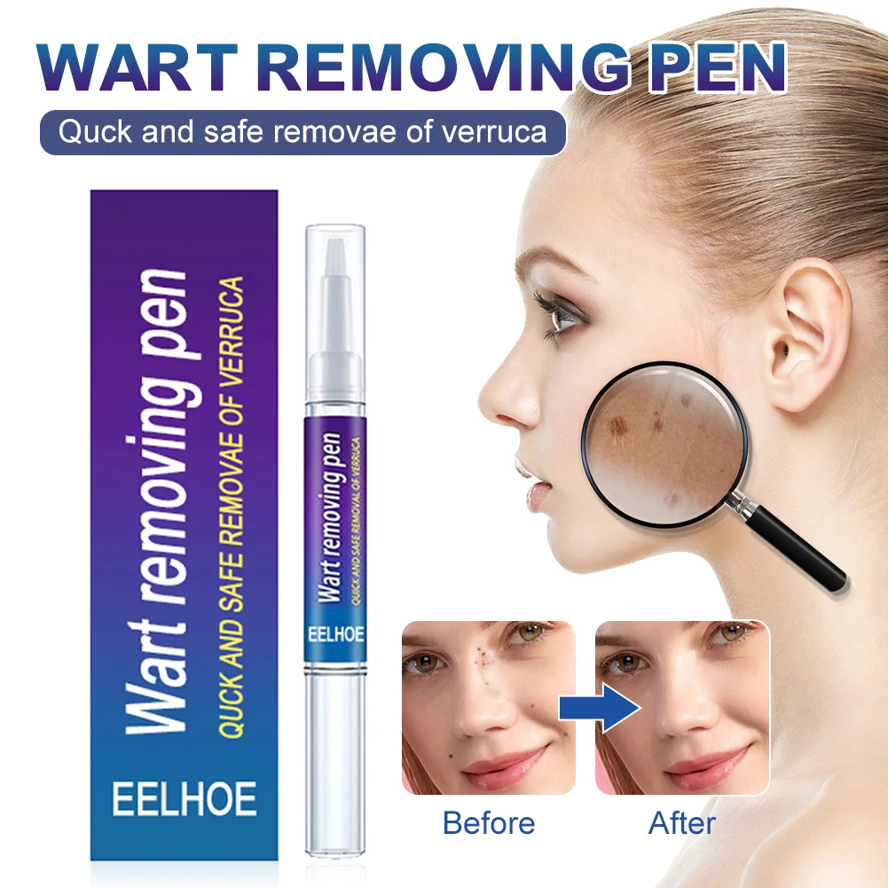 

Skin Tags & Wart Remover Pen Natural Ingredients Using herbal formula Safe and Mild Wart Callus Skin Tag Removal for Men Women