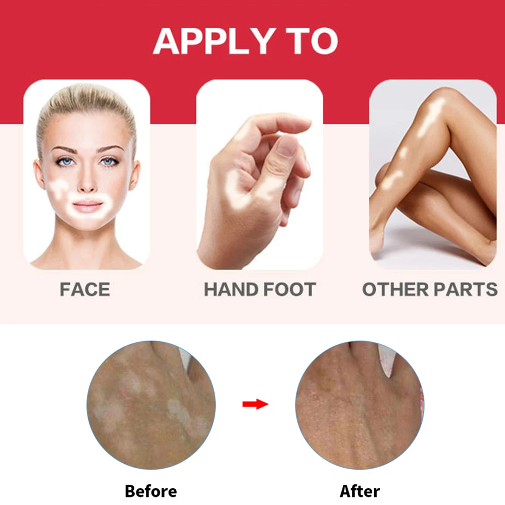 Профессиональная ручка-консилер для татуировок шрамов | Красота и здоровье