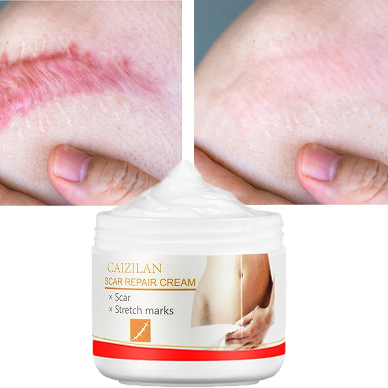 

Крем для восстановления шрамов, прыщей, растяжек, гель для лица, Удаление Сжигания шрамов, увлажнение, отбеливание, уход за кожей тела