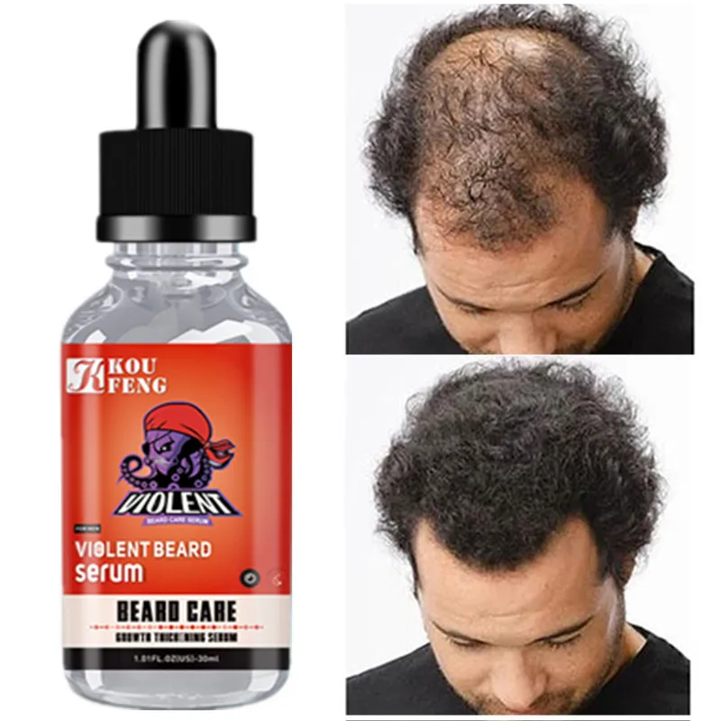 

Effective Hair Growth Serum Fast Regrowth Thick for Hair Prevent Hair Loss Damaged Hair Repair Natural Hair Care Products 30ML