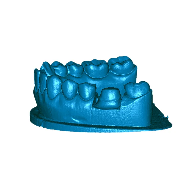 

Intraoral Scanner 3D Laser Scanner for Bite Impression Scan