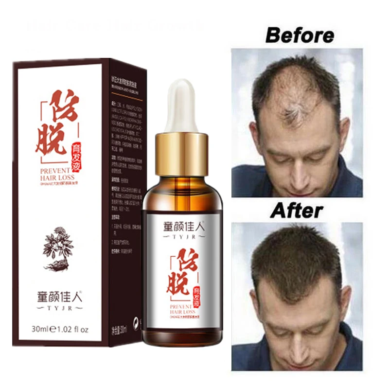 

Hair Growth Essential Oils Essence Grow Hair Treatment Prevent Hair Loss Health Care Beauty Dense Baldness Hair Growth Serum