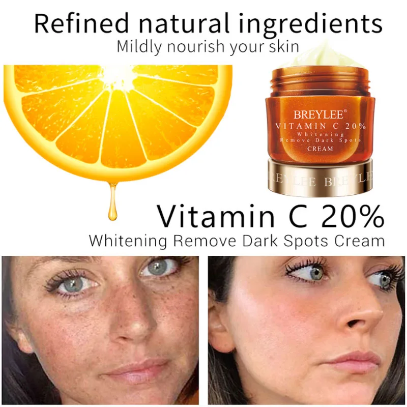 Отбеливающий крем BREYLEE для удаления темных пятен темное отбеливание кожи