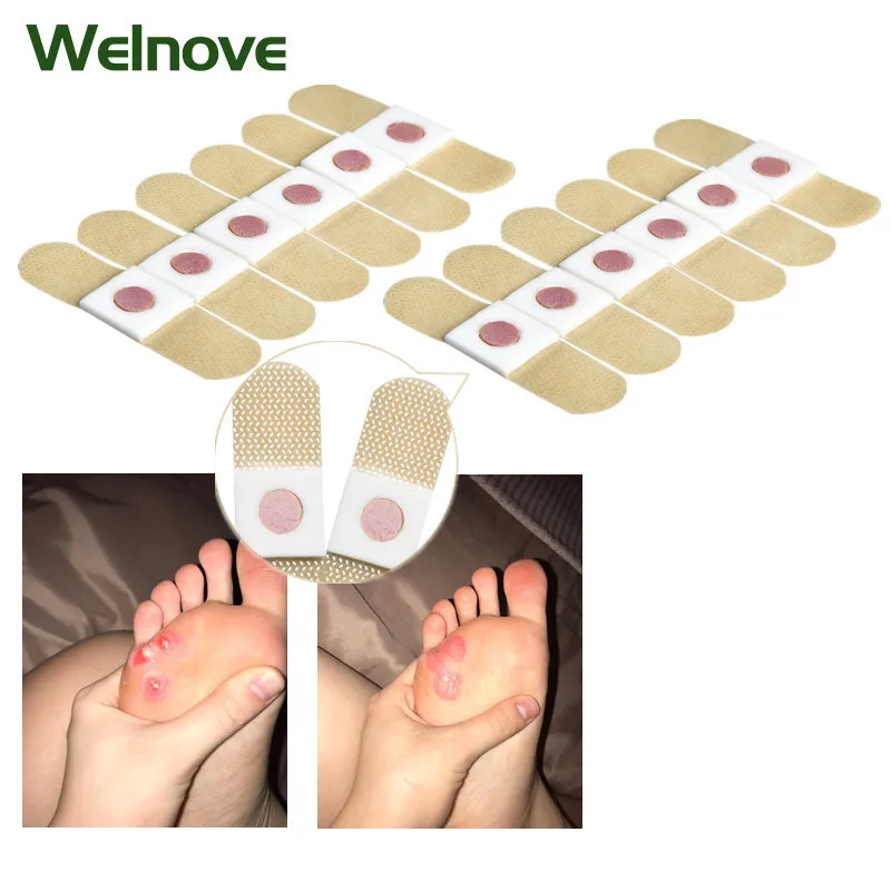 90 шт. пластыри для удаления мозолей на ногах | Красота и здоровье
