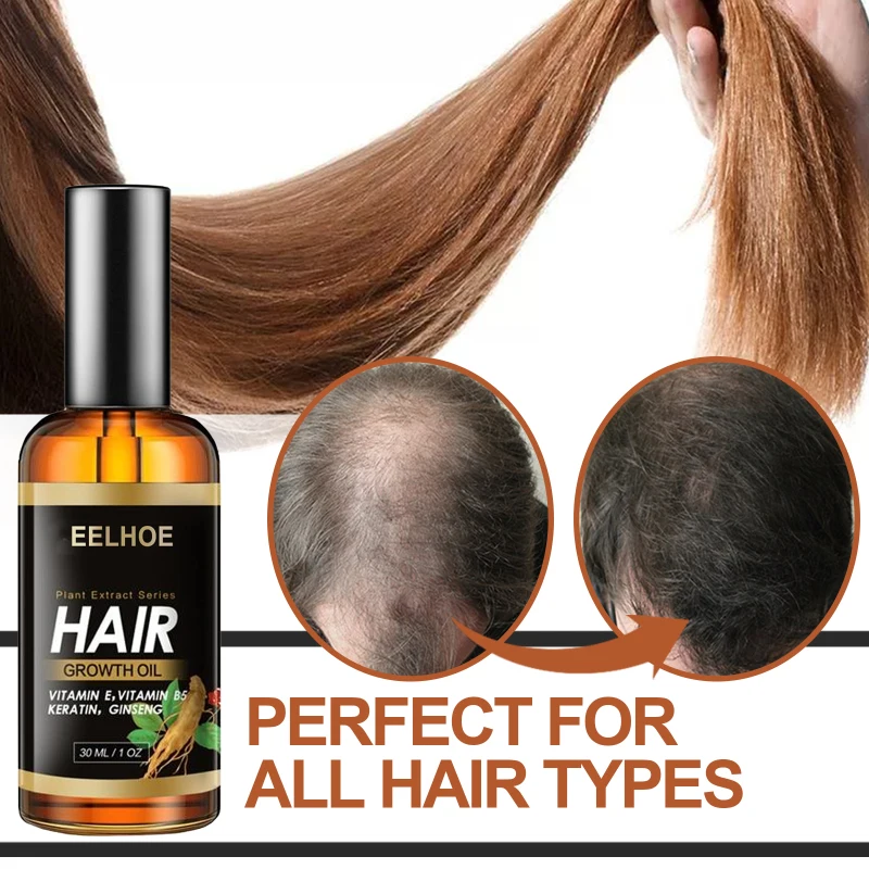 

Eelhoe Сыворотка для роста волос, приправы, марокканская Бриллиантовая сыворотка, эфирные масла, жидкость для выпадения волос, здоровый уход з...