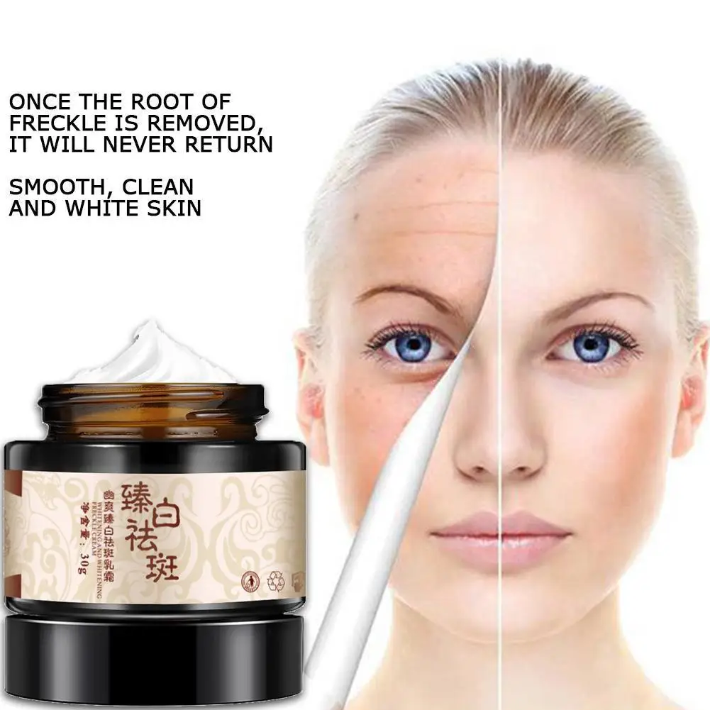 Травяной крем от акне для удаления черных точек и шрамов средство устранения