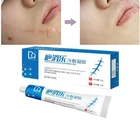 20 г крем для удаления шрамов шрамы от акне гель растяжки акне пигментация шрам ремонт хирургических пятен уход за телом сжечь правильно