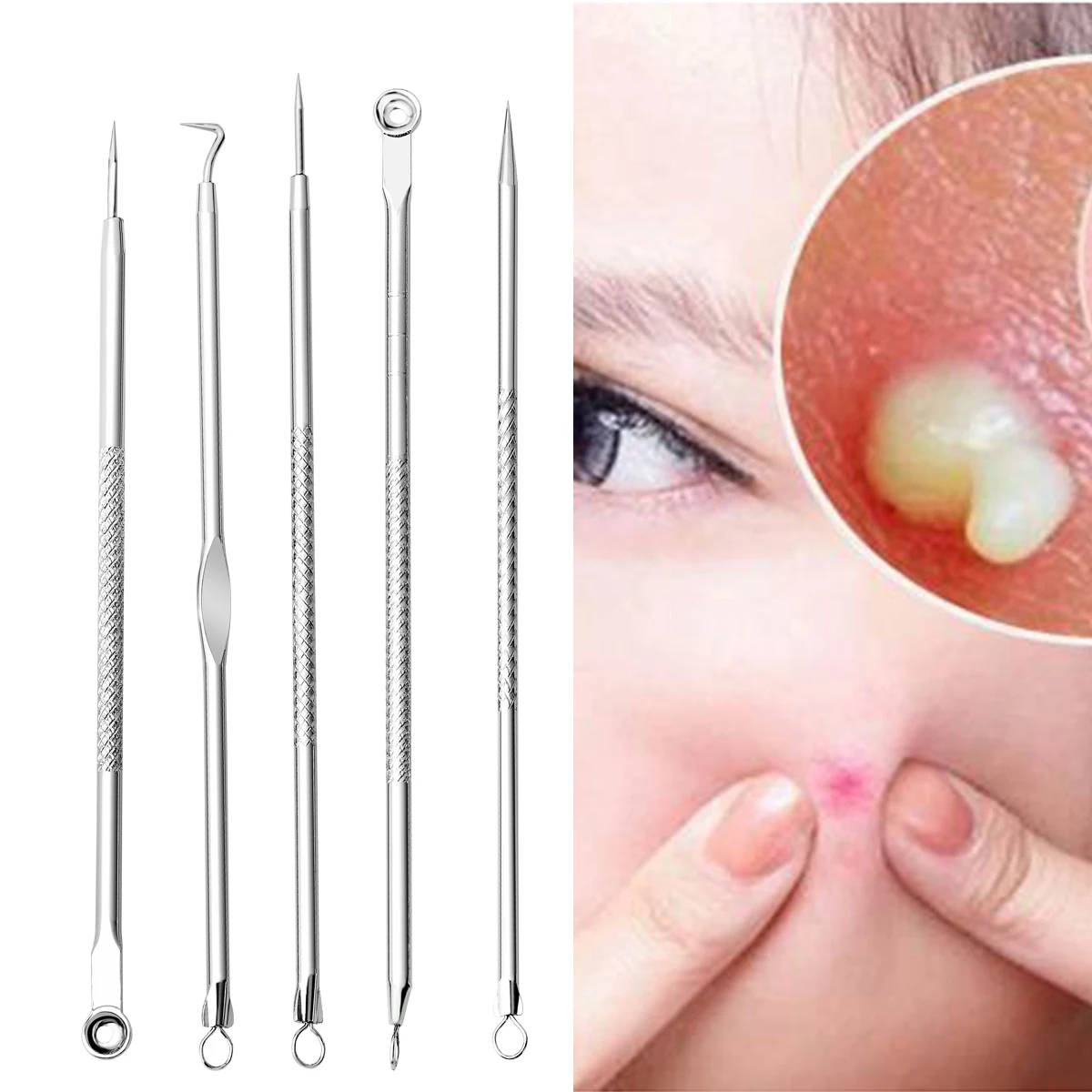 5Pcs Blackhead Removal Needles Black Dots Cleaner Stainless Steel Spot Extractor Acne Treatment Needle Face Clean Care Tool | Красота и