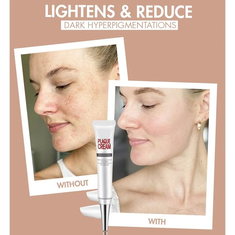

Freckle Whitening Cream Skin Moisturizing Moisturizing Freckle Facial Cream Skin Care Products Facial Care Milk Whitening Cream