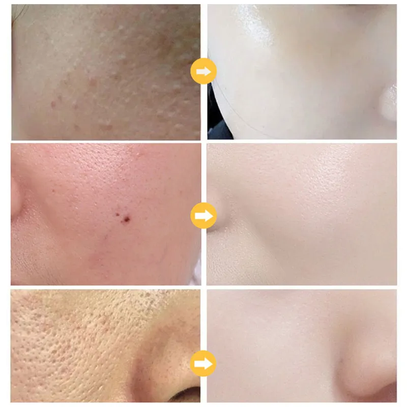 

Peel Off Mask Gold Facial Mask for Blackheads Removal Anti-aging Anti-wrinkle MPwell