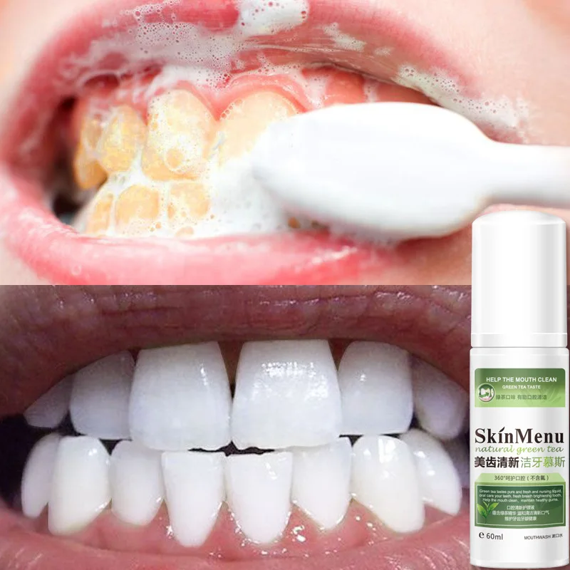 

60ml Fresh teeth Breath Tooth Whitening Cleansing Mousse Remove Oral Odor Stains Bubble toothpaste Foam Mouthwash Dental Care