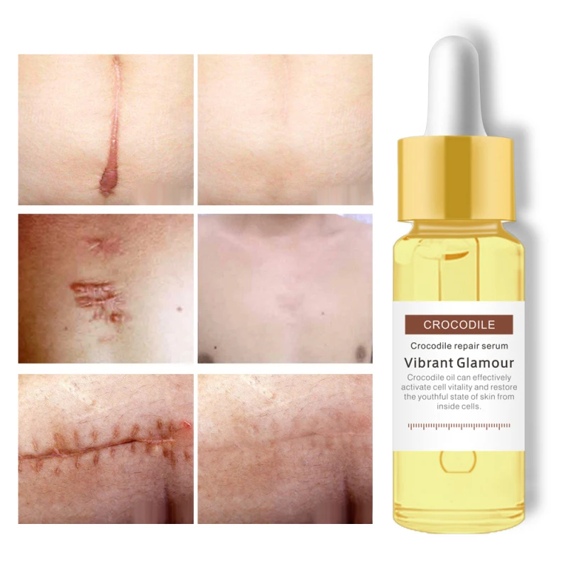 1 шт. восстанавливающая искусственная сыворотка искусственные пятна лечение