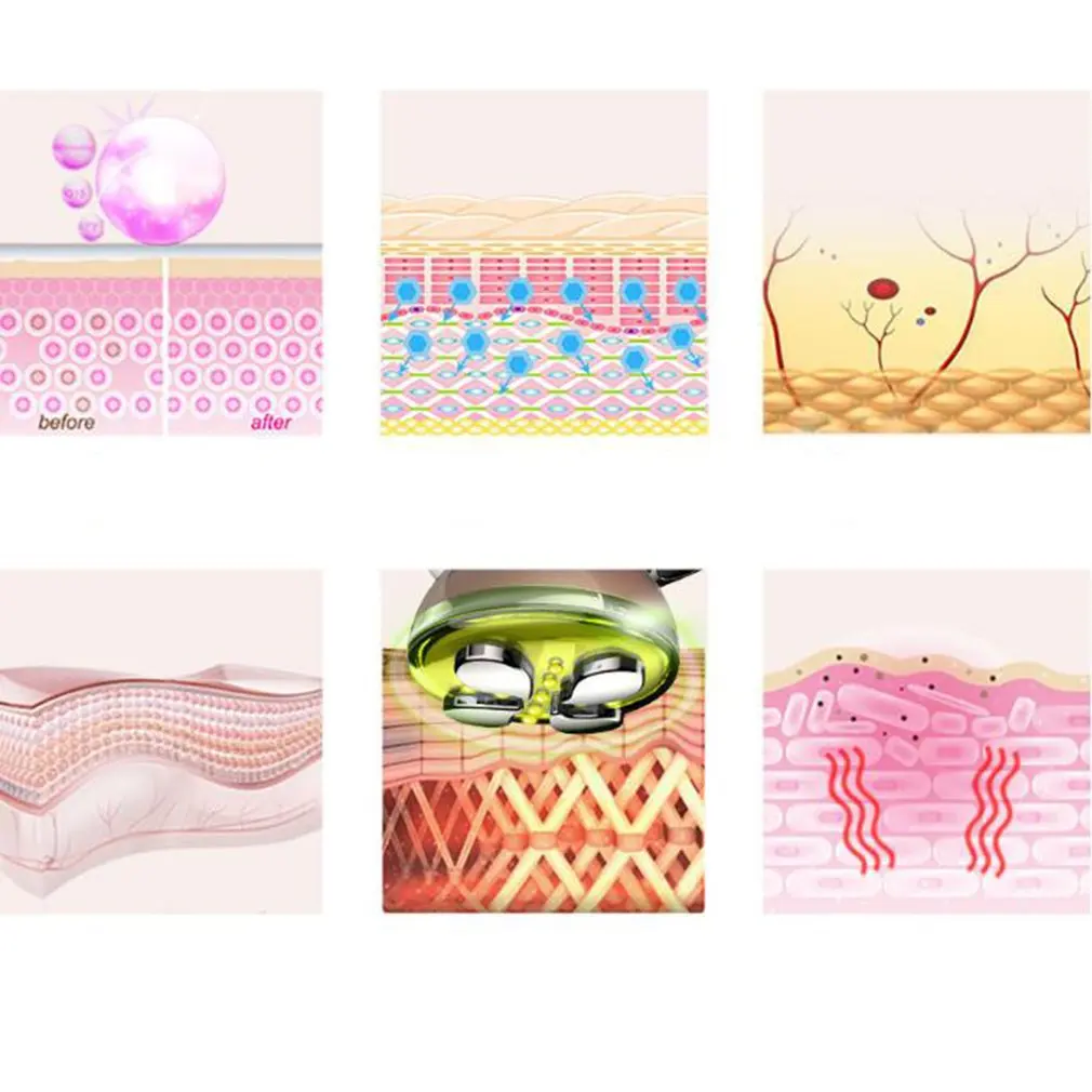 Koop Radiofrequente Machine Ultrasone Facial Kosmetiek Apparatuur Huidverstrakking Apparaat Stimulator Gezicht Licht Therapie Verjonging