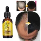 40 мл имбирный тоник для волос 7 дней имбирное масло для волос лечение выпадения волос питательный и увлажняющий уход за волосами tXTB1