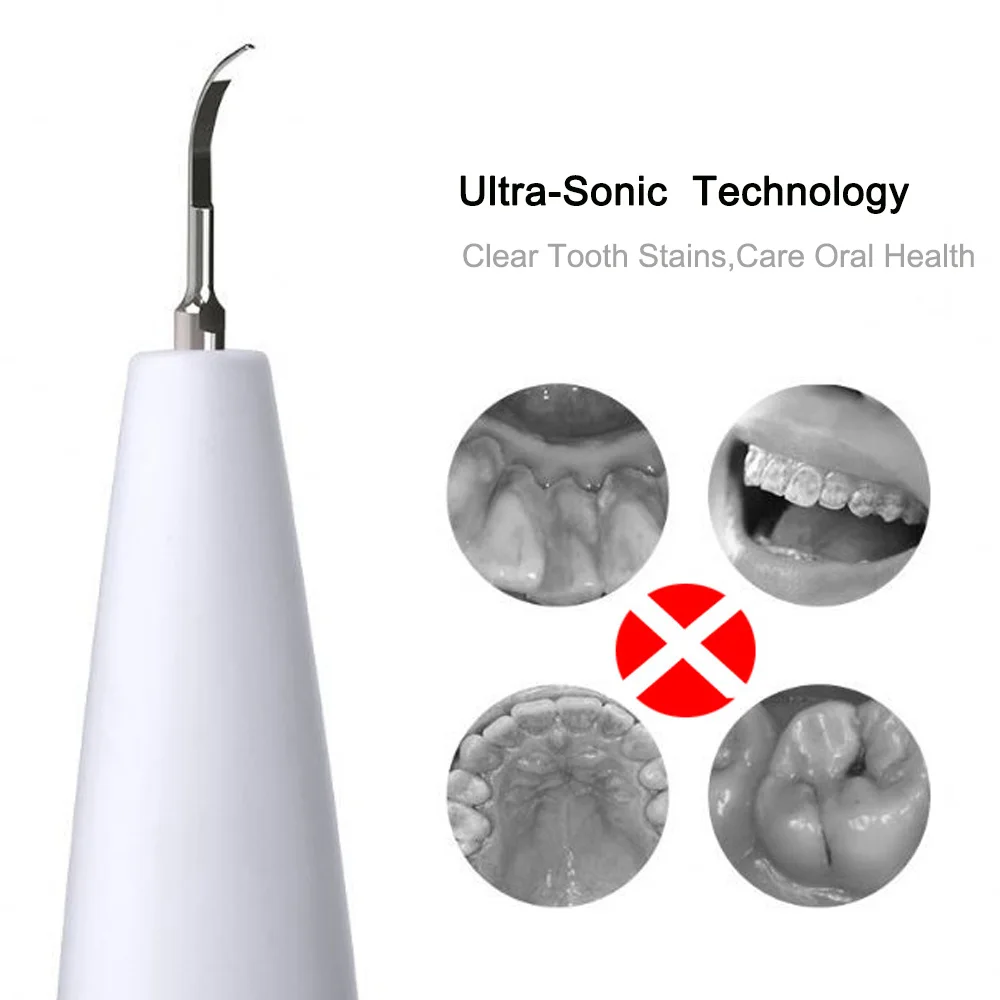 

Waterless Ultrasonic Brushing Scaler Dental Scaler Tartar Calculus Remover Tooth Stains Oral Irrigator Vibrition Teeth Cleaning