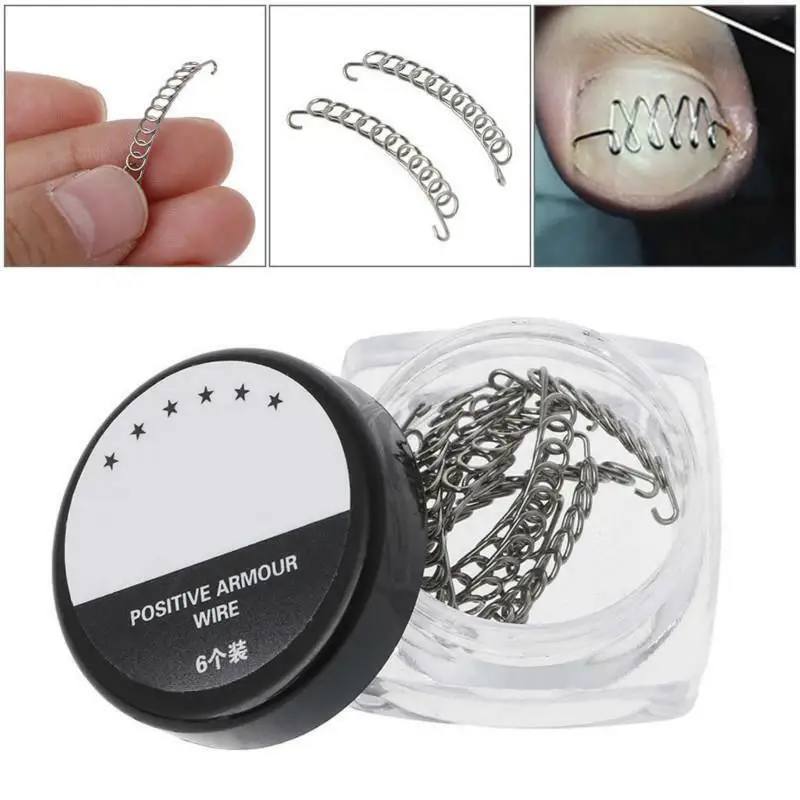 10/12 шт вросшие ногти для ног &quotфранцзуский маникюр&quot инструмент коррекции