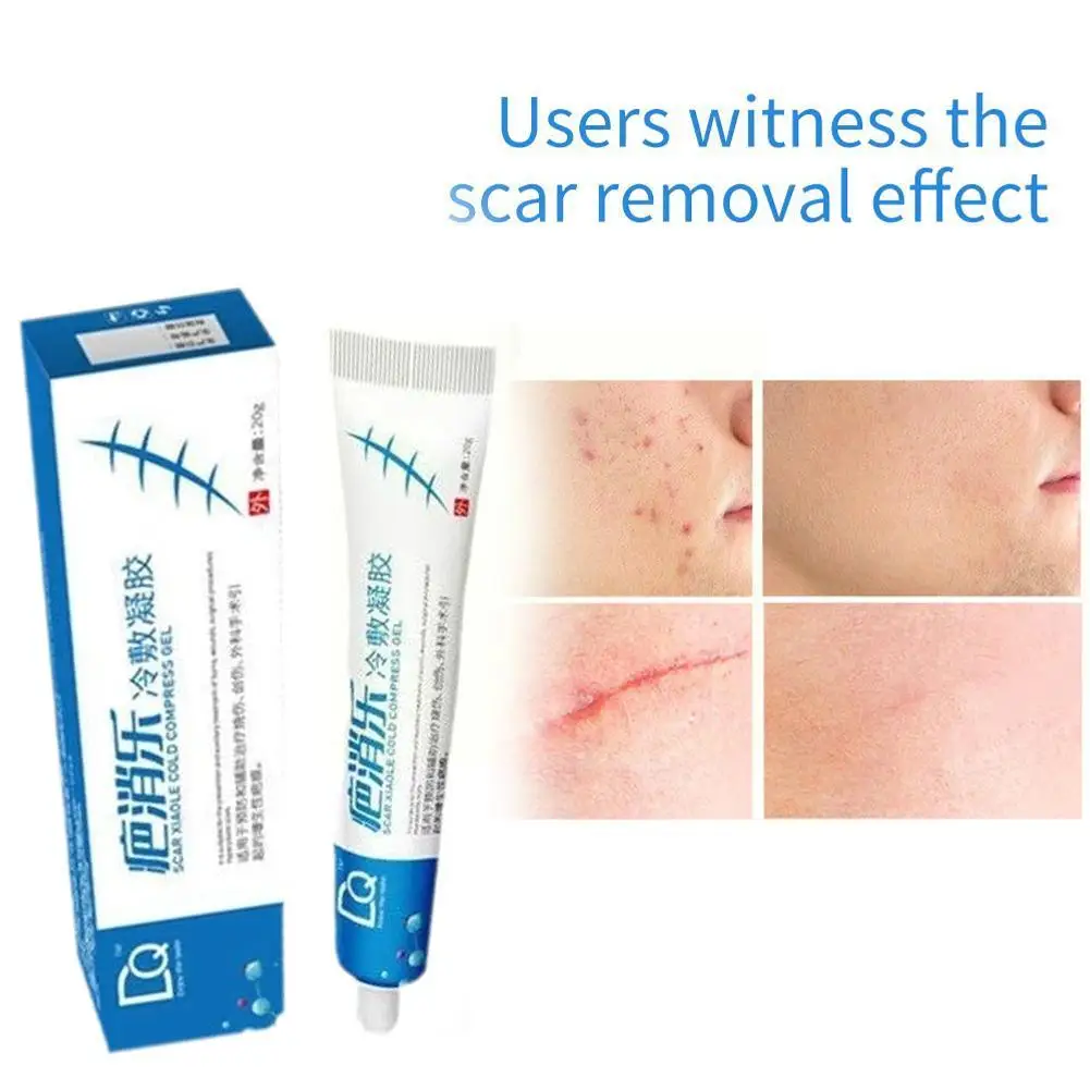 

Effective Acne Scar Removal Cream Pimples Stretch Marks Moisturizing Smoothing Face Acne Gel Care Remove Skin Whitening U9Y2