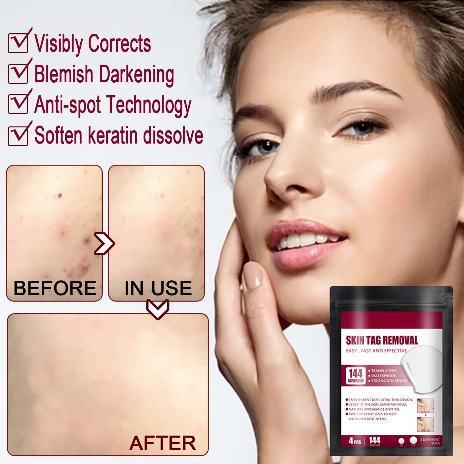 

Мгновенное удаление пятен, гель для кожи, ярлык, фотобородавок, удаление бородавок, лечение бородавок, крем для ухода за ногами, средство для...