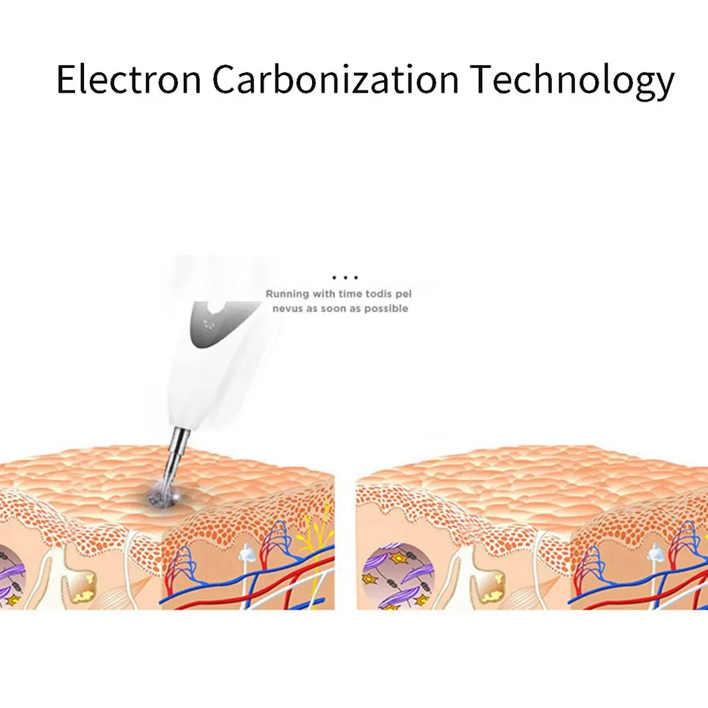 Микро Веснушка ручка Развертки Пятно машина портативный светильник для лица