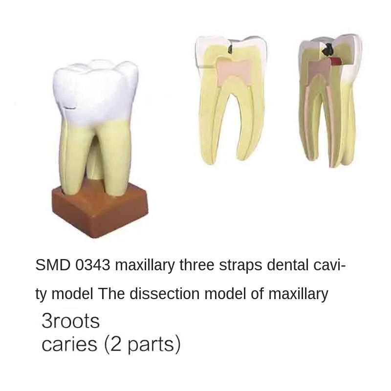 

SMD0343 Upper jaw three C models