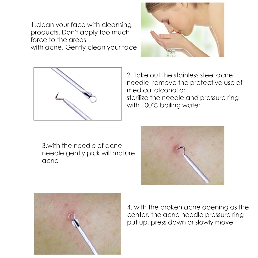 4 шт. крючки для удаления чёрных точек на комедоне | Красота и здоровье
